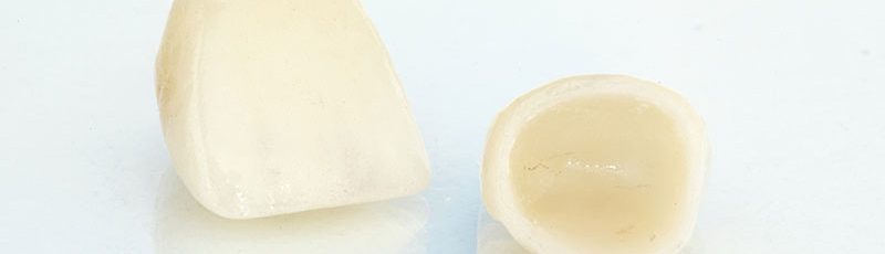 Dental Crowns