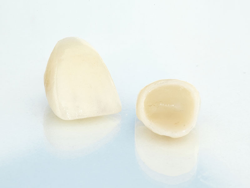 dental crowns in winnipeg